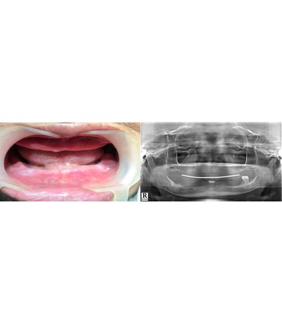 CT CONE BEAM