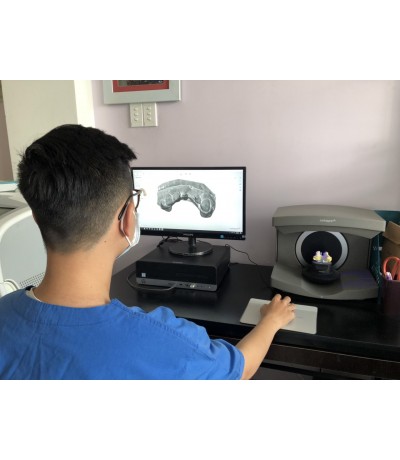SCAN DẤU HÀM 3D 4.0