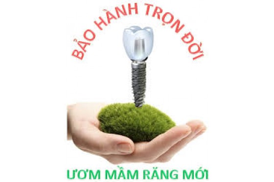 Chế độ bảo hành Implant 
