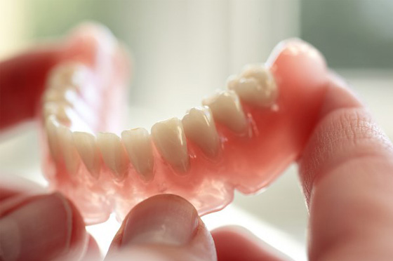 Giải pháp cho người mất răng toàn hàm