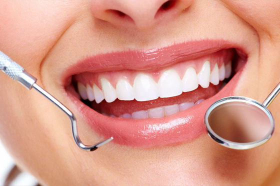 Veneer - Giải pháp phục hình thẩm mỹ bảo tồn răng thật