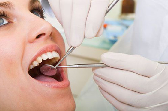 Khi nào nên làm Implant - Chi phí cấy ghép Implant